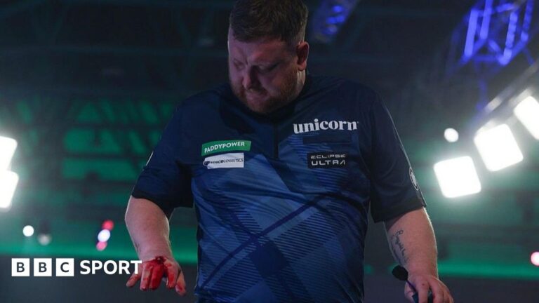 Cameron Menzies was pictured with blood on his right hand as he left the stage